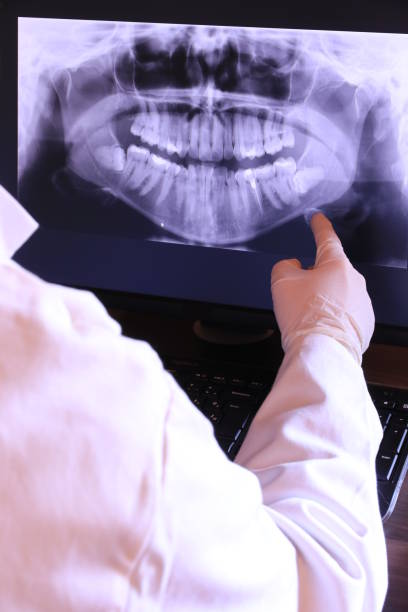 Best Emergency Root Canal Therapy in Fowlkes, TN
