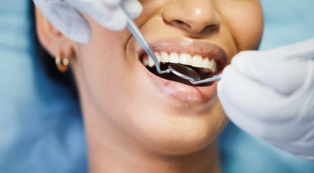 Best Emergency Wisdom Tooth Extraction in Fowlkes, TN