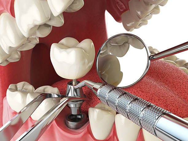 Best Emergency Care for Gum Disease in Fowlkes, TN